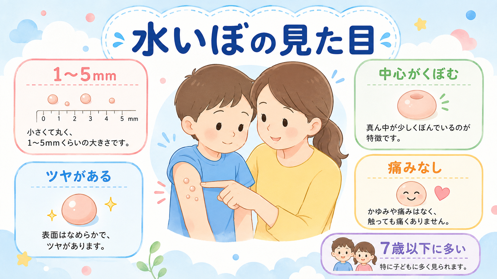 水いぼの見た目の特徴を示す解説パネル。中央に子どもの腕にできた小さなツヤのあるいぼをやさしく指し示す親子のイラスト、周囲に「1〜5mm」「中心がくぼむ」「ツヤが...