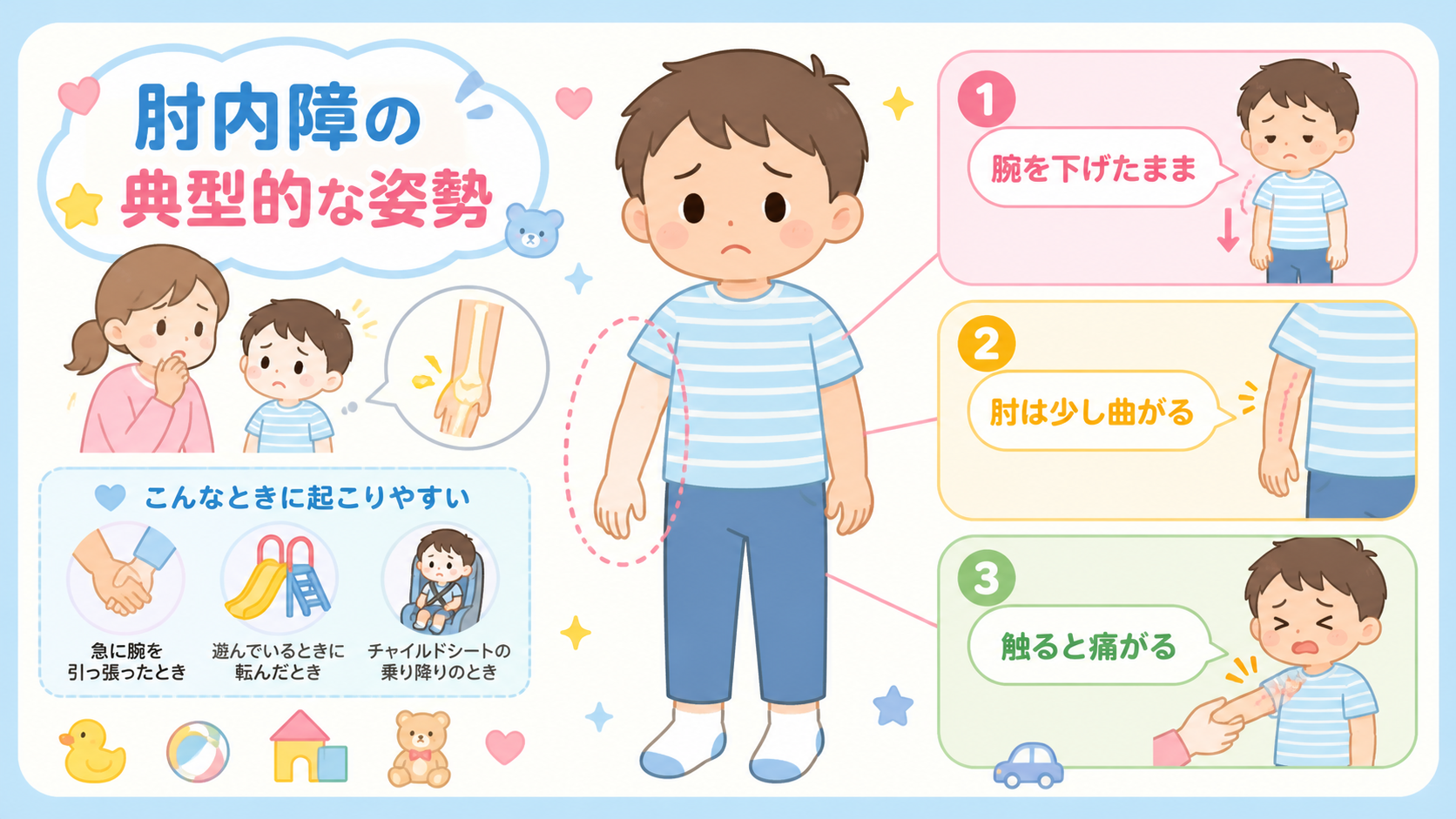 肘内障の典型的な姿勢を示したイラスト図解。子どもが片腕を体の横にだらんと下げ、肘を少し曲げたまま動かさない様子を大きく描き、「腕を下げたまま」「肘は少し曲がる」...