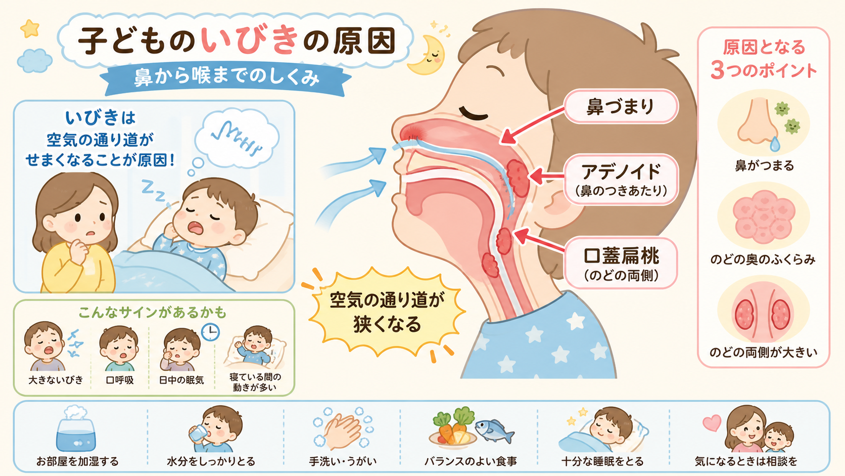 子どものいびきの原因を鼻から喉までの断面図で示した図解。「鼻づまり」「アデノイド(鼻のつきあたり)」「口蓋扁桃(のどの両側)」の3箇所に矢印と日本語ラベルを配置...
